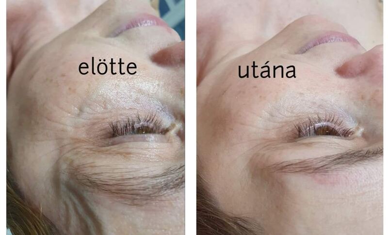 előtte utána kép, kozmetika 4