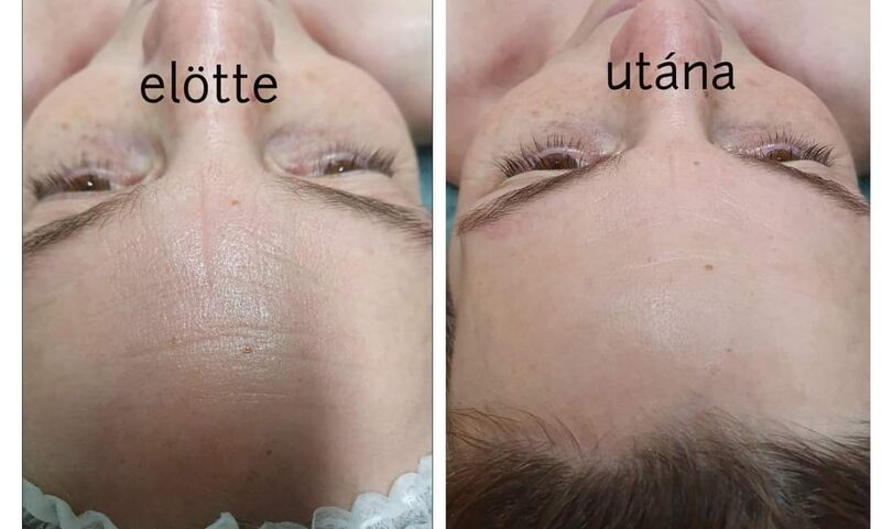 előtte utána kép, kozmetika 4