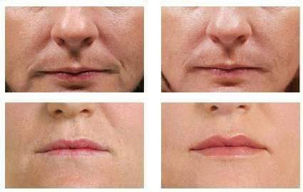 előtte utána kép, kozmetika 3