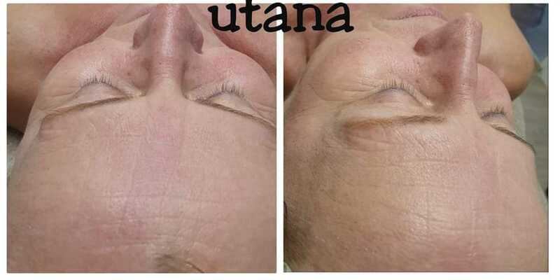 előtte utána kép, kozmetika 2